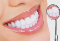 LÀM RĂNG SỨ THẨM MỸ