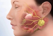 ĐIỀU TRỊ VIÊM KHỚP THÁI DƯƠNG
