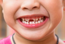 CẨM NANG RĂNG HÀM MẶT NHỮNG ĐIỀU CẦN BIẾT!