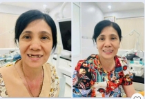 răng toàn sứ