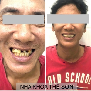 Khách hàng 12