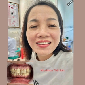 Khách hàng 11