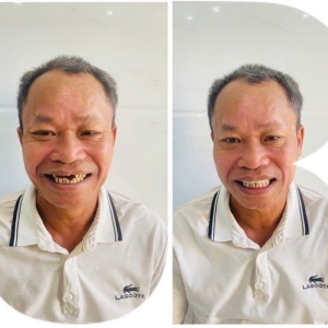 Khách hàng 17