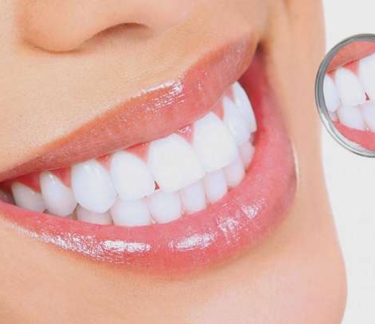 LÀM RĂNG SỨ THẨM MỸ