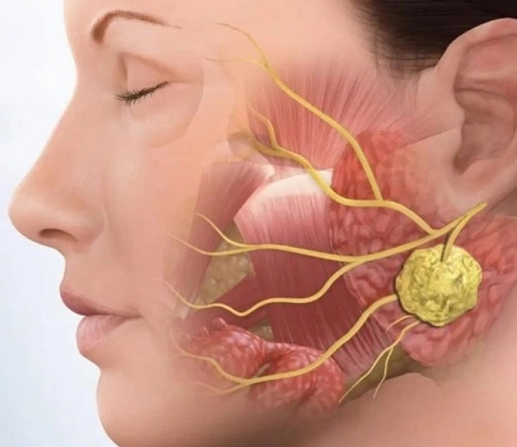 ĐIỀU TRỊ VIÊM KHỚP THÁI DƯƠNG